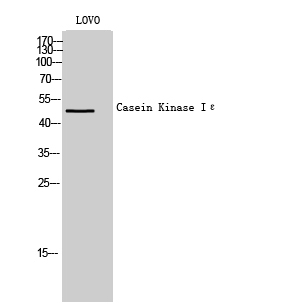 Fig1:; Western Blot analysis of LOVO cells using Casein Kinase Iε Polyclonal Antibody