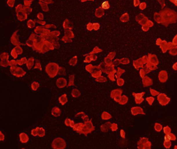 Fig2: ICC staining of FGFR2 in MCF-7 cells (red). Cells were fixed in paraformaldehyde, permeabilised with 0.25% Triton X100/PBS.