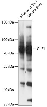 Western blot - GLE1 Polyclonal Antibody 