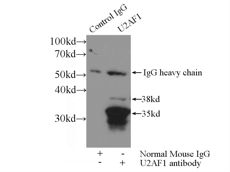 IP Result of anti-U2AF35 (IP:Catalog No:107652, 3ug; Detection:Catalog No:107652 1:500) with HeLa cells lysate 3000ug.
