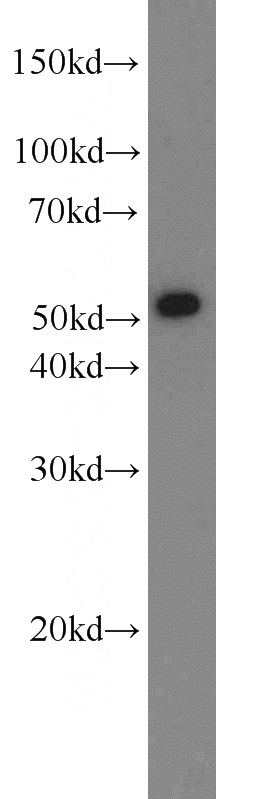 mouse liver tissue were subjected to SDS PAGE followed by western blot with Catalog No:112160(LBP antibody) at dilution of 1:1000