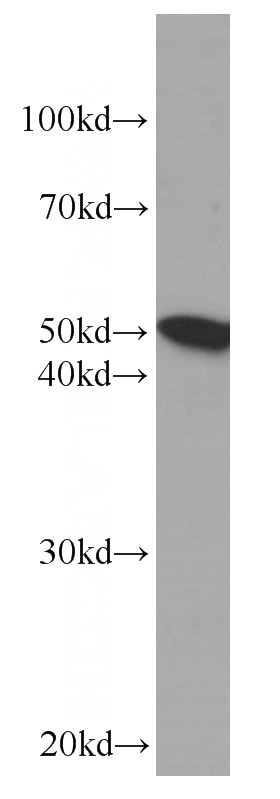 human heart tissue were subjected to SDS PAGE followed by western blot with Catalog No:107211(FGB Antibody) at dilution of 1:1000