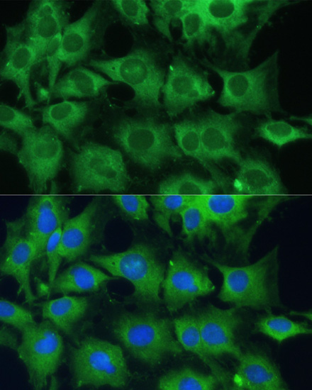 Immunofluorescence - PTPN22 Polyclonal Antibody 