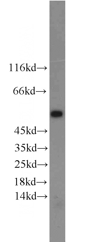 mouse testis tissue were subjected to SDS PAGE followed by western blot with Catalog No:113802(EGLN2 antibody) at dilution of 1:1000