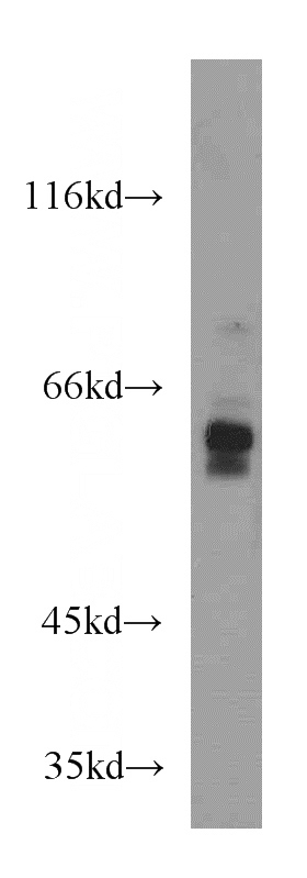 Jurkat cells were subjected to SDS PAGE followed by western blot with Catalog No:111092(N-PAC antibody) at dilution of 1:500