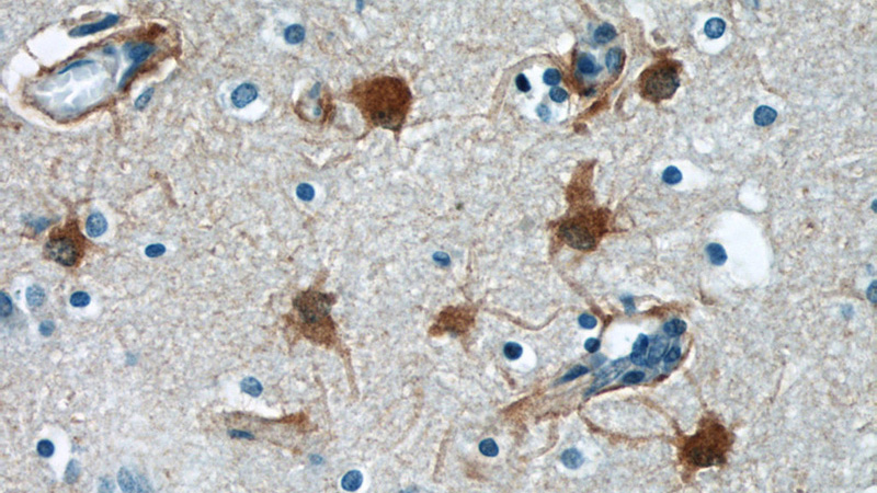 Immunohistochemical of paraffin-embedded human brain using Catalog No:114178(PRDX6 antibody) at dilution of 1:50 (under 40x lens)