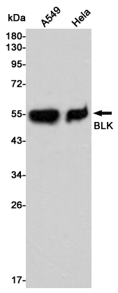 Western blot detection of BLK in A549 and Hela cell lysates using BLK mouse mAb (1:5000 diluted).Predicted band size:55KDa.Observed band size:55KDa.