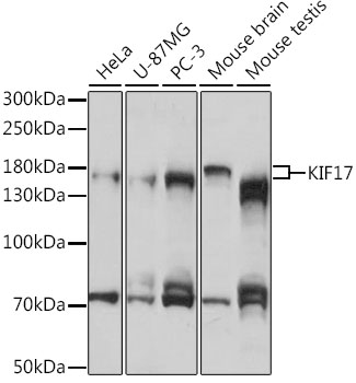 Western blot - KIF17 Polyclonal Antibody 