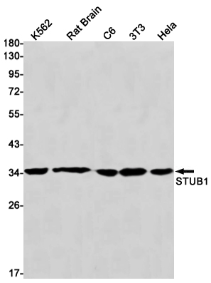 Western blot detection of STUB1 in K562,Rat Brain,C6,3T3,Hela cell lysates using STUB1 Rabbit mAb(1:1000 diluted).Predicted band size:35kDa.Observed band size:35kDa.