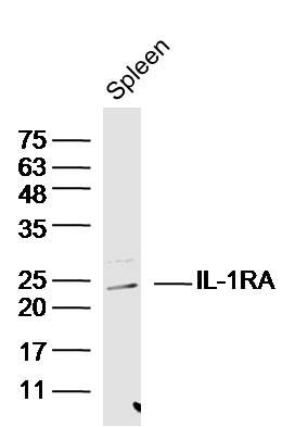 Fig3: Sample: Spleen(Mouse) Tissue Lysate at 30 ug; Primary: Anti-IL-1RA at 1/300 dilution; Secondary: IRDye800CW Goat Anti-Rabbit IgG at 1/20000 dilution; Predicted band size: 18 kD; Observed band size: 23 kD