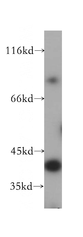Jurkat cells were subjected to SDS PAGE followed by western blot with Catalog No:113977(PNMA2 antibody) at dilution of 1:400