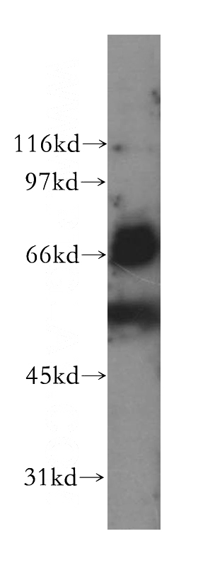 Jurkat cells were subjected to SDS PAGE followed by western blot with Catalog No:112226(LILRB5 antibody) at dilution of 1:1500