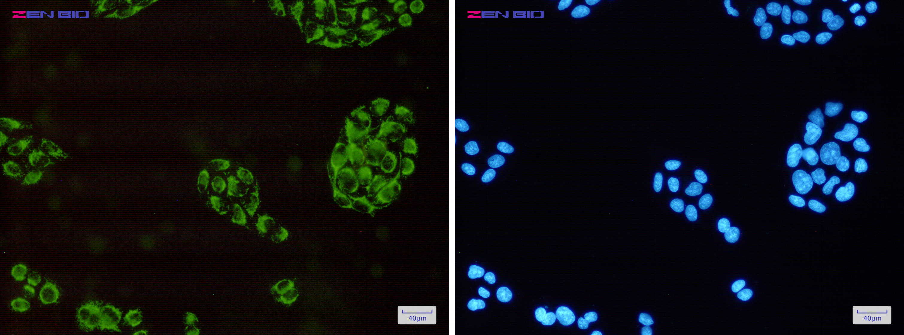 Immunocytochemistry of HADHA(green) in Hela cells using HADHA Rabbit pAb at dilution 1/50, and DAPI(blue)
