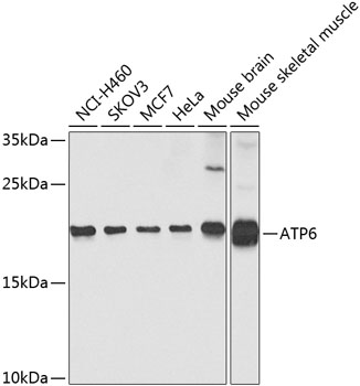 Western blot - ATP6 Polyclonal Antibody 