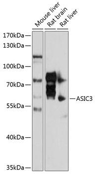 Western blot - ASIC3 Polyclonal Antibody 