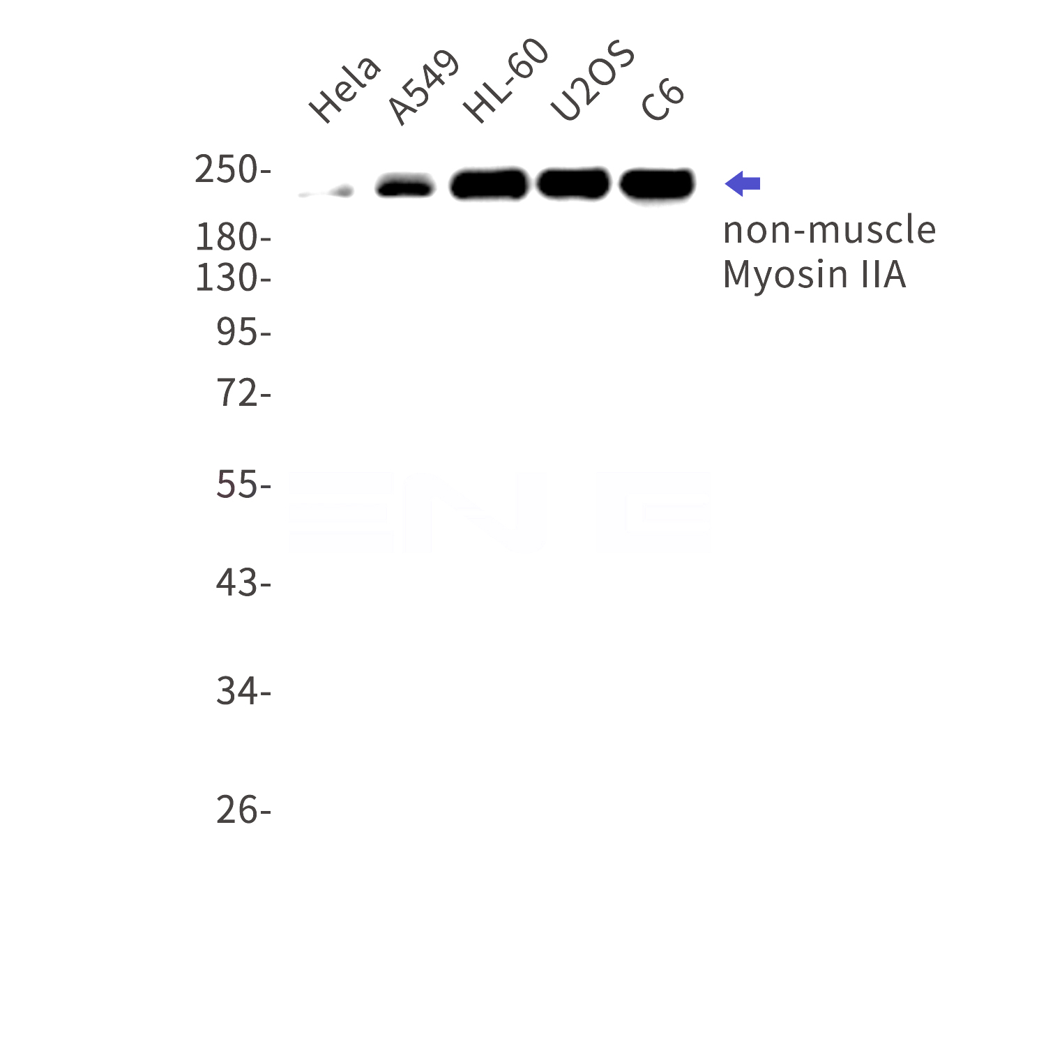 Western blot detection of non-muscle Myosin IIA in Hela,A549,HL-60,U2OS,C6 cell lysates using non-muscle Myosin IIA Rabbit mAb(1:1000 diluted).Predicted band size:227kDa.Observed band size:227kDa.
