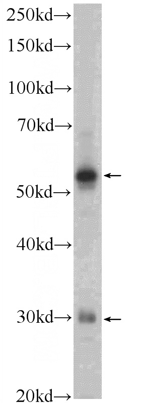 MDA-MB-453s cells were subjected to SDS PAGE followed by western blot with Catalog No:116983(XBP1 Antibody) at dilution of 1:300