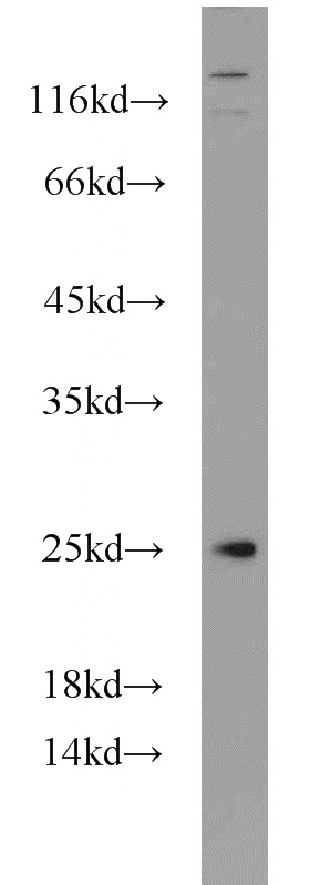 PC-3 cells were subjected to SDS PAGE followed by western blot with Catalog No:109185(CEP70 antibody) at dilution of 1:600
