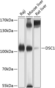 Western blot - DSC1 Polyclonal Antibody 