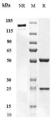 SDS-PAGE