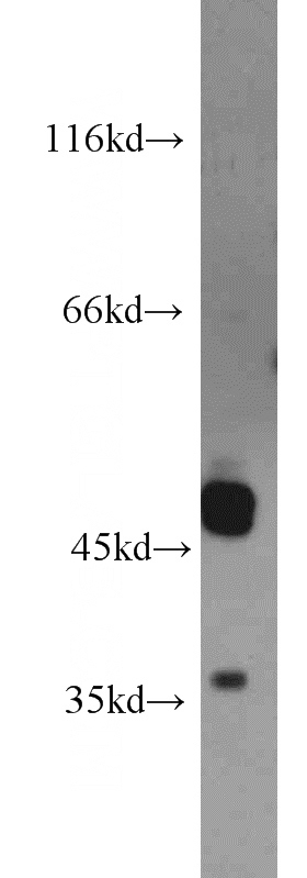 HeLa cells were subjected to SDS PAGE followed by western blot with Catalog No:116621(UNKL antibody) at dilution of 1:1500