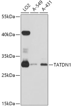 Western blot - TATDN1 Polyclonal Antibody 