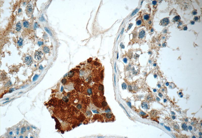 Immunohistochemistry of paraffin-embedded human testis tissue slide using Catalog No:109231(CHMP1A Antibody) at dilution of 1:50 (under 40x lens)