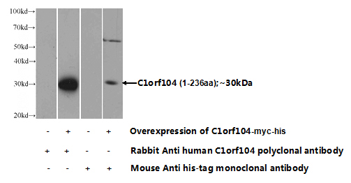 Transfected HEK-293 cells were subjected to SDS PAGE followed by western blot with Catalog No:108630(C1orf104 Antibody) at dilution of 1:1000