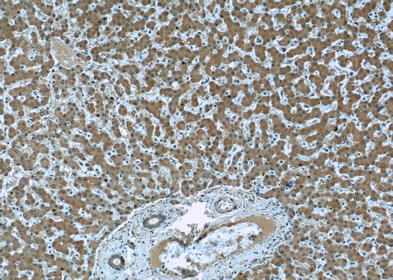 Immunohistochemistry of paraffin-embedded human liver slide using Catalog No:107165(CLU Antibody) at dilution of 1:50 (under 10x lens)