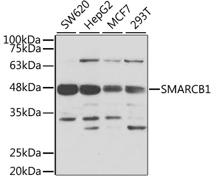 Western blot - SMARCB1 Polyclonal Antibody 