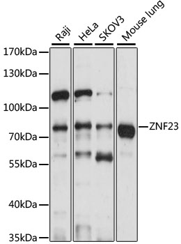 Western blot - ZNF23 Polyclonal Antibody 