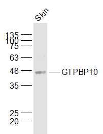 Fig1: Sample:; Skin (Mouse) Lysate at 40 ug; Primary: Anti-GTPBP10 at 1/1000 dilution; Secondary: IRDye800CW Goat Anti-Rabbit IgG at 1/20000 dilution; Predicted band size: 43 kD; Observed band size: 45 kD