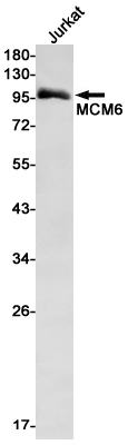 Western blot detection of MCM6 in Jurkat cell lysates using MCM6 Rabbit mAb(1:1000 diluted).Predicted band size:93kDa.Observed band size:93kDa.