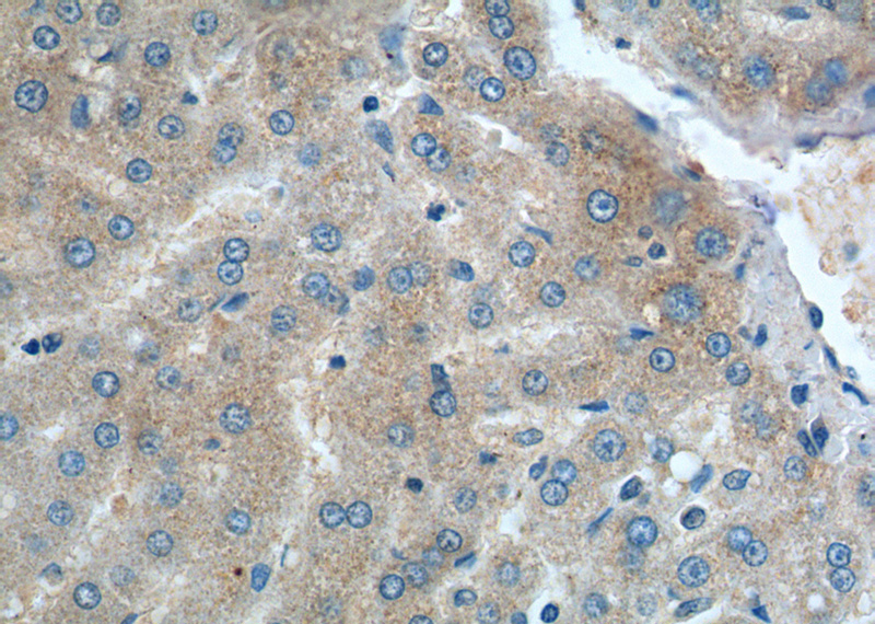 Immunohistochemistry of paraffin-embedded human liver tissue slide using Catalog No:109888(DENND1A Antibody) at dilution of 1:200 (under 40x lens).