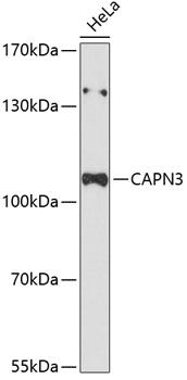 Western blot - CAPN3 Polyclonal Antibody 