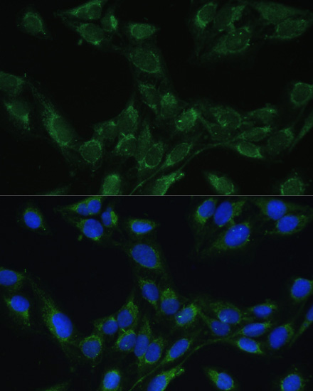 Immunofluorescence - BLOC1S3 Polyclonal Antibody 