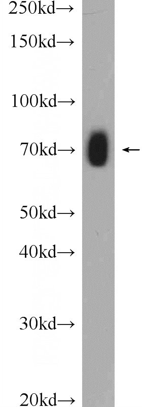mouse brain tissue were subjected to SDS PAGE followed by western blot with Catalog No:110933(GEFT Antibody) at dilution of 1:300