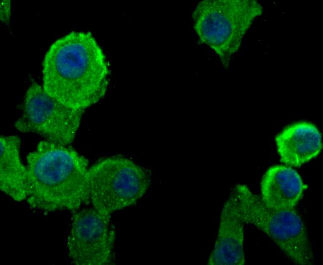 Fig4: ICC staining PRTN3 in A549 cells (green). The nuclear counter stain is DAPI (blue). Cells were fixed in paraformaldehyde, permeabilised with 0.25% Triton X100/PBS.