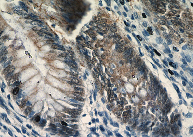 Immunohistochemical of paraffin-embedded human colon using Catalog No:108631(C1orf106 antibody) at dilution of 1:50 (under 40x lens)