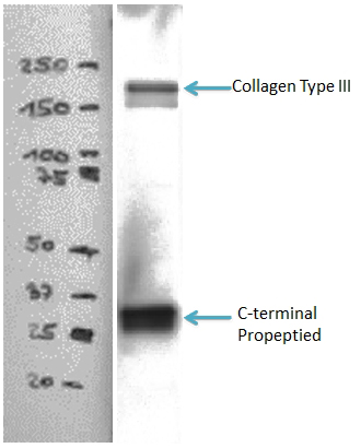 WB result of Collagen Type III antibody (Catalog No:109378, 1:5000) with hVFFA8 cells lysate.