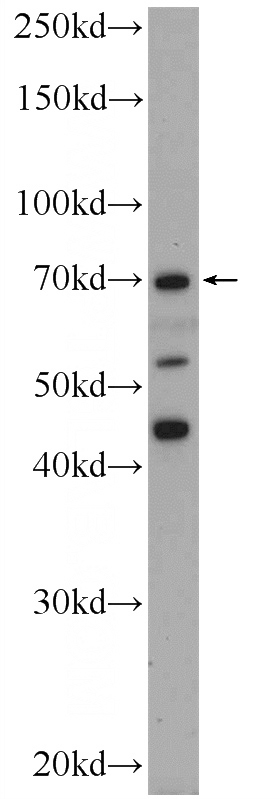 HepG2 cells were subjected to SDS PAGE followed by western blot with Catalog No:110531(FASTKD3 Antibody) at dilution of 1:300