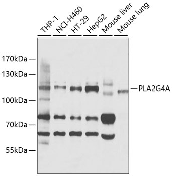 Western blot - PLA2G4A Polyclonal Antibody 