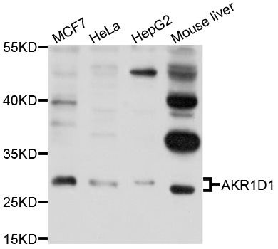 Western blot - AKR1D1 Polyclonal Antibody 