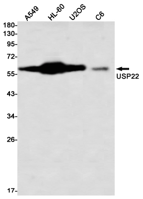Western blot detection of USP22 in A549,HL-60,U2OS,C6 using USP22 Rabbit mAb(1:1000 diluted)