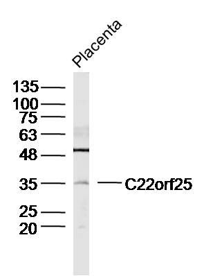 Fig1: Sample:Placenta (Mouse) Lysate at 40 ug; Primary: Anti- C22orf25 at 1/300 dilution; Secondary: IRDye800CW Goat Anti-Rabbit IgG at 1/20000 dilution; Predicted band size: 31kD; Observed band size: 35kD