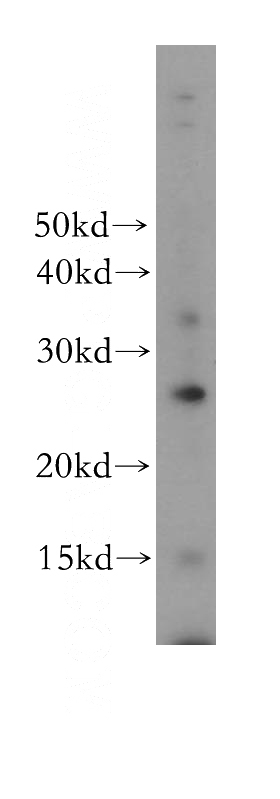 human brain tissue were subjected to SDS PAGE followed by western blot with Catalog No:110492(EVI2A antibody) at dilution of 1:300