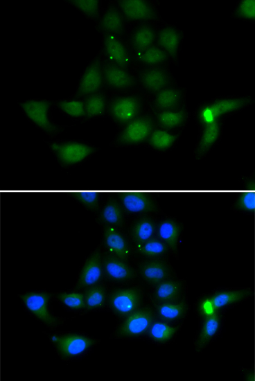 Immunofluorescence - TAT Polyclonal Antibody 