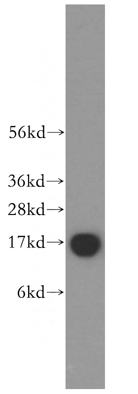human brain tissue were subjected to SDS PAGE followed by western blot with Catalog No:116519(UBE2D3 antibody) at dilution of 1:500