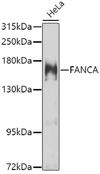 Western blot - FANCA Polyclonal Antibody 
