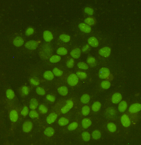 Immunocytochemistry staining of HeLa cells fixed with 4% Paraformaldehyde and using anti-Ring1A mouse mAb (dilution 1:200).